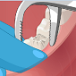 Operate Now! Dental Implant